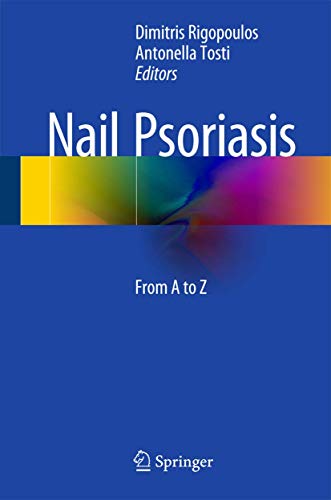 Nail Psoriasis: From A to Z