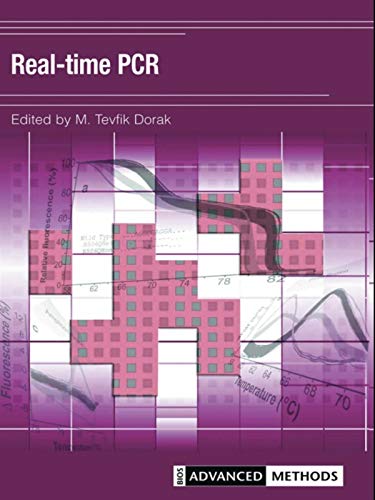 Real-time PCR (Advanced Methods) (English Edition)