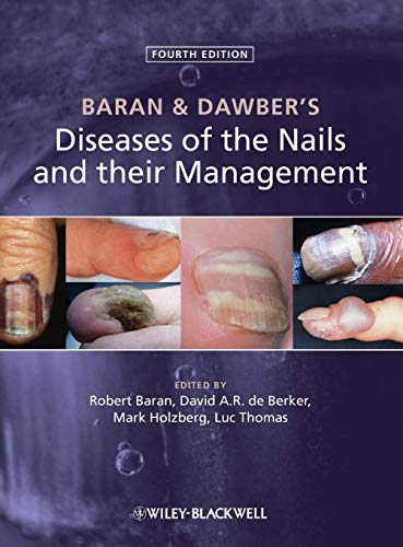 Baran and Dawber's Diseases of the Nails and their Management