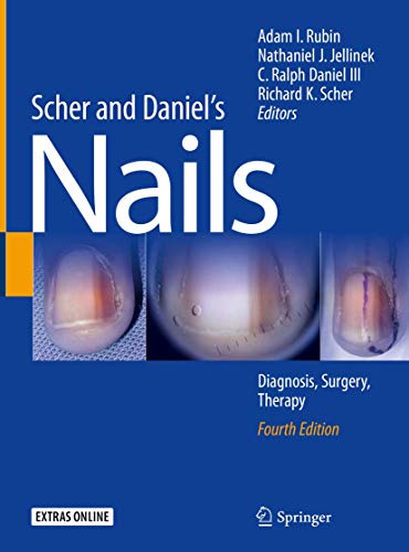 Scher and Daniel's Nails: Diagnosis, Surgery, Therapy